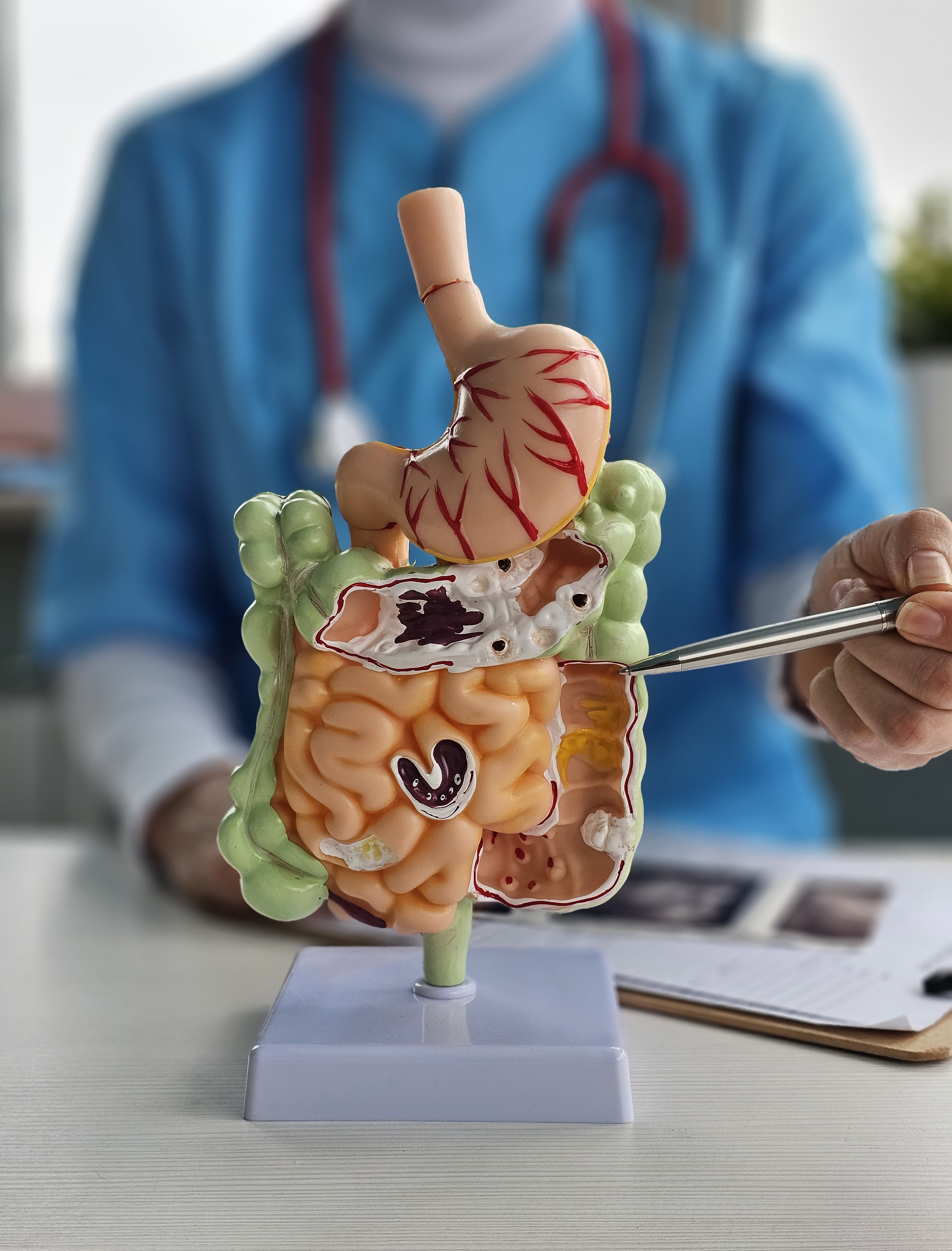 Common Diseases of the Digestive System