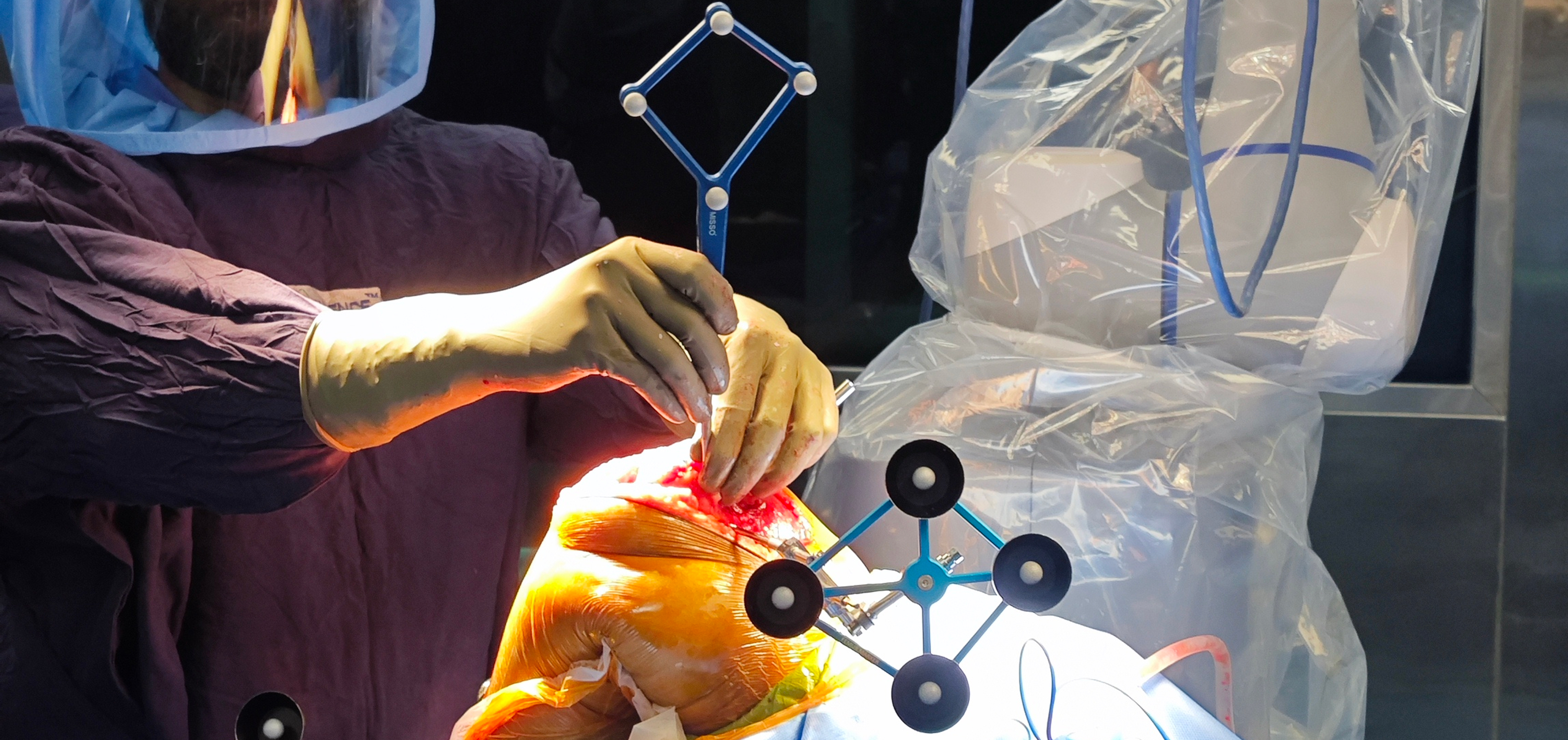 The Future of Knee Care